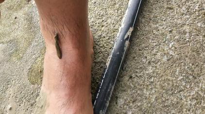 在农村不小心吃了蚂蟥 - 西瓜视频